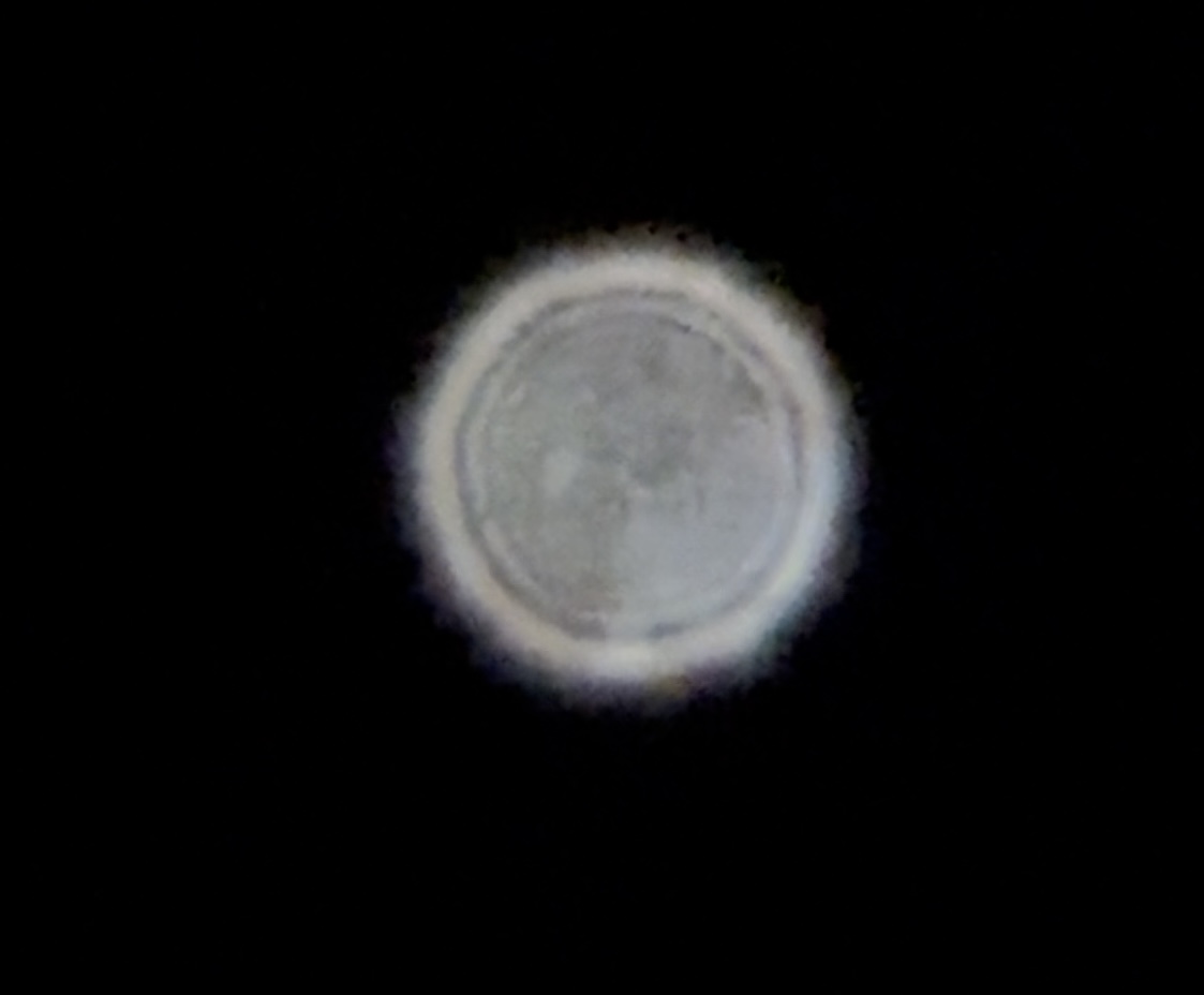 Ts 102 apo intra.jpg