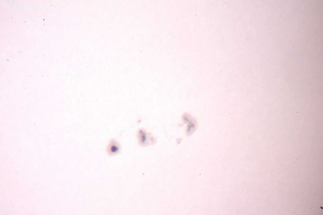 Sonnenfleck 25.12. 2015.JPG